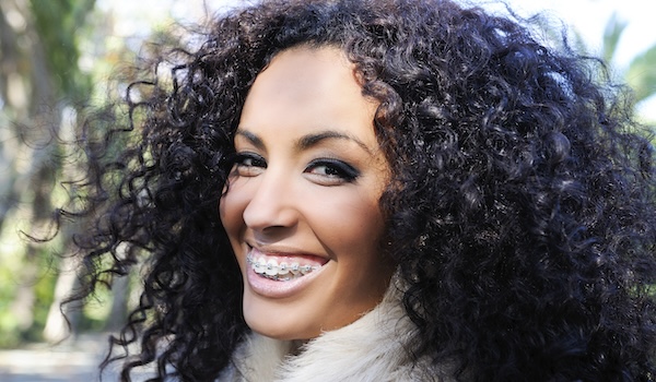 woman in braces smiling outdoors