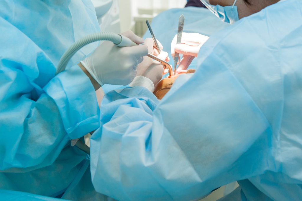 Oral surgery dentist in Chula Vista, CA