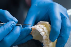 Dental restoration dentist in Chula Vista, CA