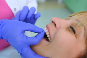 Dental veneers dentist in Chula Vista, CA